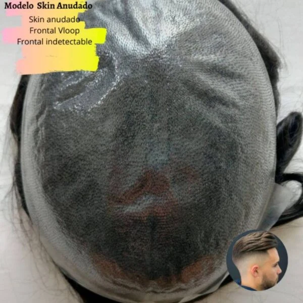 Prótesis Capilar Skin Anudado