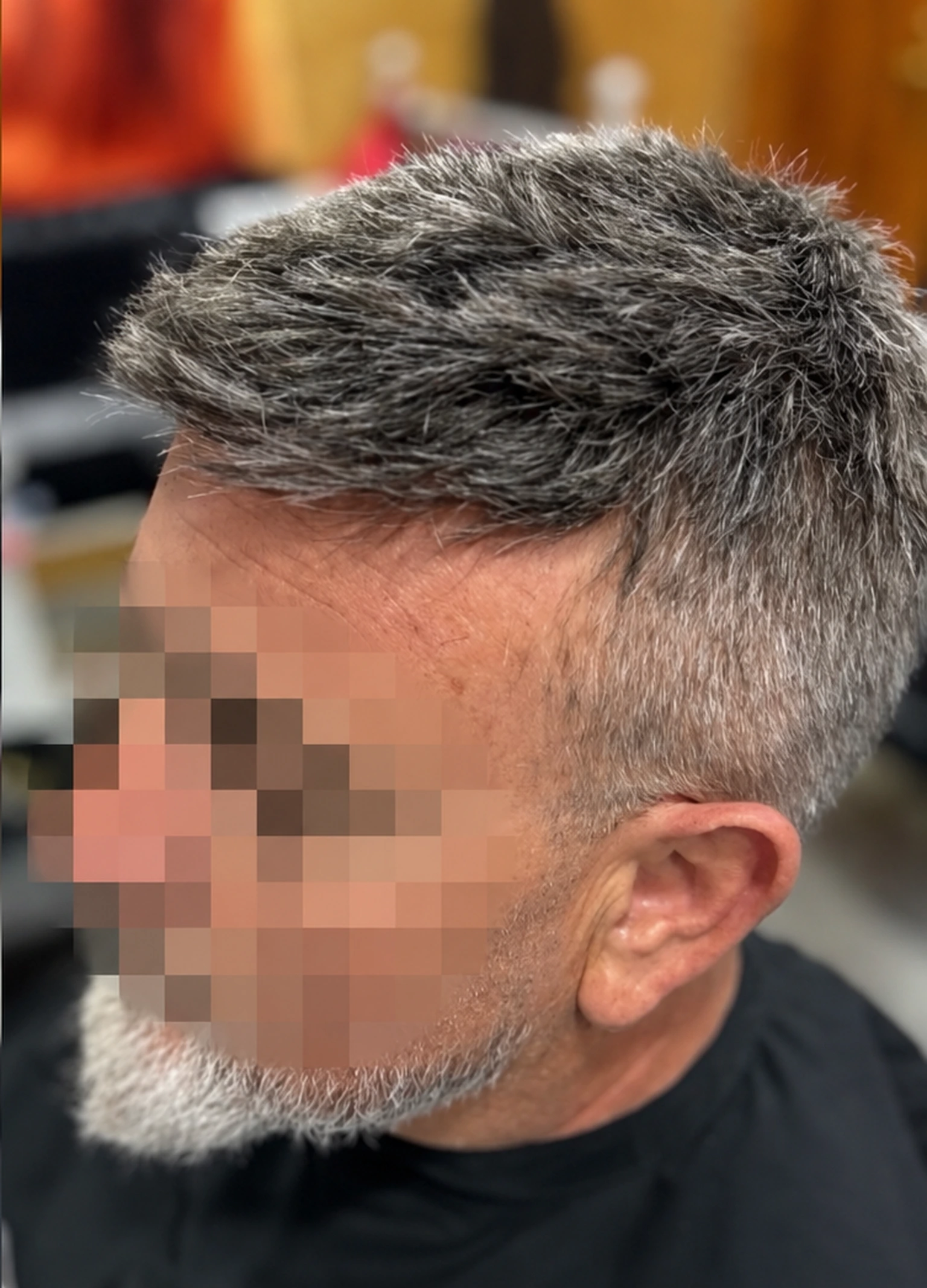 Prótesis capilar de hombre: qué necesitas para tu primer pedido