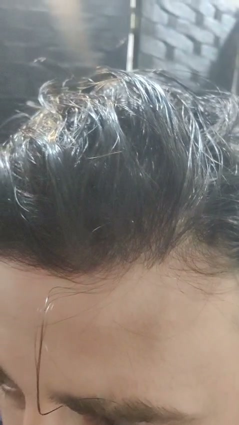 Haarsystem-Ergebnisse: echte Bilder und Videos
